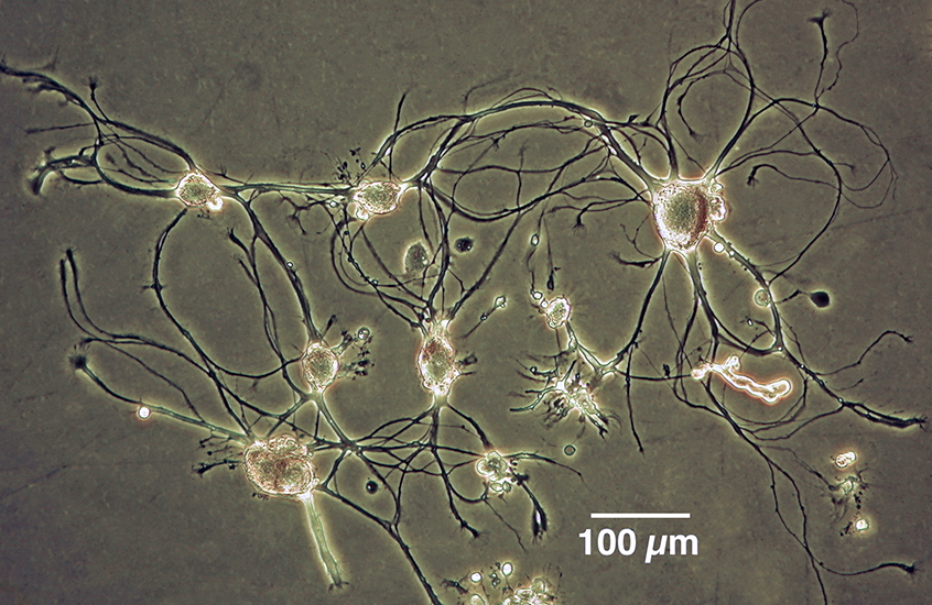 The Nervous System of Aplysia californica 